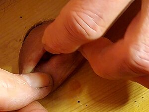 Staple cbt