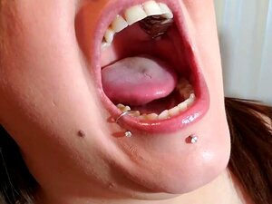 Angelo giovane che indossa protesi parziali