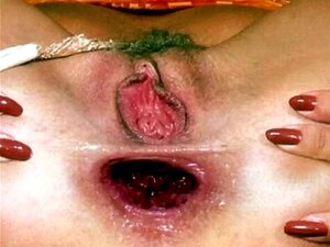 Verwendete Gaping Assmeat (Slideshow)