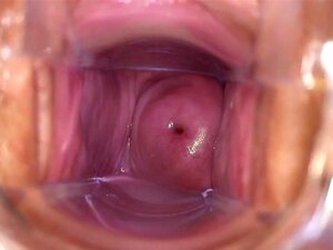 Hawt Hotty benutzt Spekulum, um ihren Muttermund zu zeigen