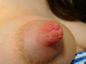 Große nippel